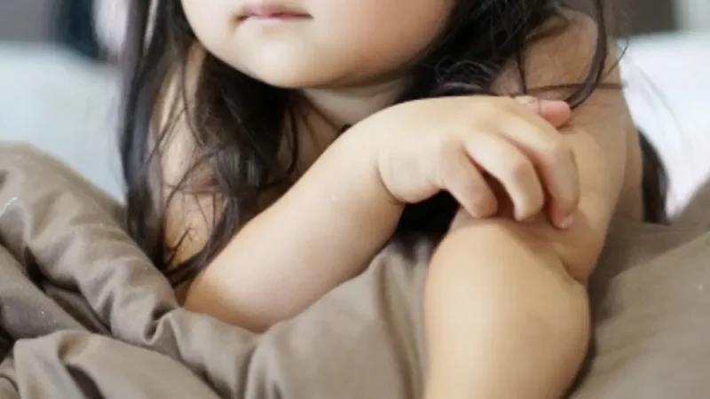 子供　アトピー