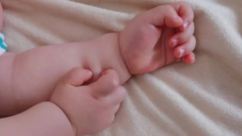 赤ちゃん　掻きむしる